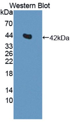 Invitrogen IL11RA Polyclonal Antibody 20 &mu;L; Unconjugated:Antibodies,