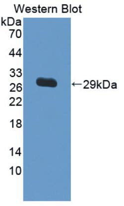Invitrogen IL17RC Polyclonal Antibody:Antibodies:Primary Antibodies