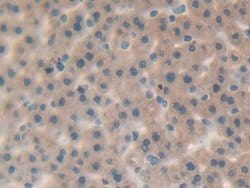 IL-25 Polyclonal Antibody, Invitrogen 20 &mu;L; Unconjugated:Antibodies,