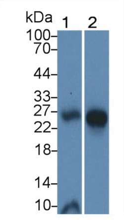 IL-25 Polyclonal Antibody, Invitrogen 20 &mu;L; Unconjugated:Antibodies,