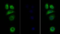 Invitrogen IL31RA Polyclonal Antibody 20 &mu;L; Unconjugated:Antibodies,