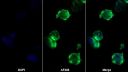 Invitrogen IL31RA Polyclonal Antibody 20 &mu;L; Unconjugated:Antibodies,