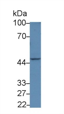 Invitrogen IL31RA Polyclonal Antibody 20 &mu;L; Unconjugated:Antibodies,