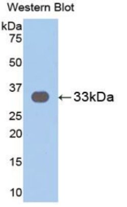 Invitrogen IL31RA Polyclonal Antibody 20 &mu;L; Unconjugated:Antibodies,