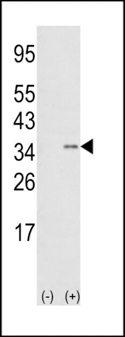 Invitrogen SNAIL Polyclonal Antibody 400 &mu;L; Unconjugated:Antibodies,
