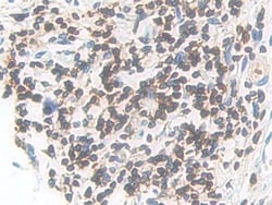 Invitrogen CD127 Polyclonal Antibody 20 &mu;L; Unconjugated:Antibodies,