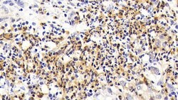 Invitrogen CD127 Polyclonal Antibody 20 &mu;L; Unconjugated:Antibodies,