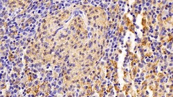Invitrogen IBA1 Polyclonal Antibody:Antibodies:Primary Antibodies