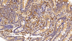 Invitrogen IBA1 Polyclonal Antibody:Antibodies:Primary Antibodies