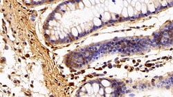 Invitrogen IBA1 Polyclonal Antibody:Antibodies:Primary Antibodies