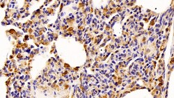 Invitrogen IBA1 Polyclonal Antibody:Antibodies:Primary Antibodies