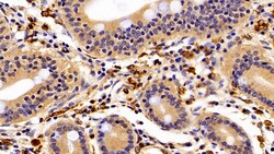 Invitrogen IBA1 Polyclonal Antibody:Antibodies:Primary Antibodies