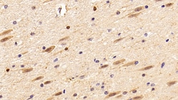 Invitrogen IBA1 Polyclonal Antibody:Antibodies:Primary Antibodies