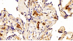 Invitrogen IBA1 Polyclonal Antibody:Antibodies:Primary Antibodies