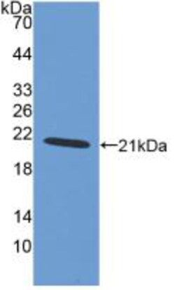 Invitrogen IBA1 Polyclonal Antibody:Antibodies:Primary Antibodies