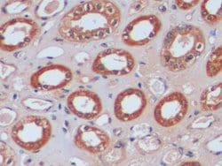 Invitrogen IDH1 Polyclonal Antibody:Antibodies:Primary Antibodies