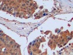 Invitrogen IDH1 Polyclonal Antibody:Antibodies:Primary Antibodies