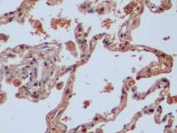 Invitrogen IDH1 Polyclonal Antibody:Antibodies:Primary Antibodies