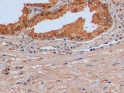 Invitrogen IDH1 Polyclonal Antibody:Antibodies:Primary Antibodies