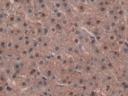 Invitrogen IDH1 Polyclonal Antibody:Antibodies:Primary Antibodies