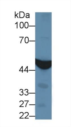Invitrogen IDH1 Polyclonal Antibody:Antibodies:Primary Antibodies
