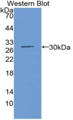 Invitrogen IDH1 Polyclonal Antibody:Antibodies:Primary Antibodies