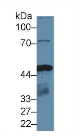 Invitrogen IDH1 Polyclonal Antibody:Antibodies:Primary Antibodies