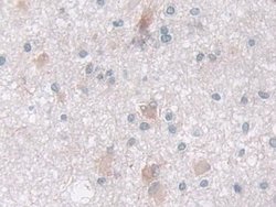 Invitrogen IDH2 Polyclonal Antibody:Antibodies:Primary Antibodies