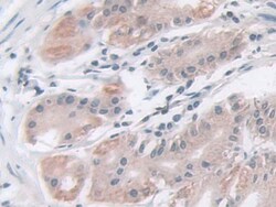 Invitrogen IDH2 Polyclonal Antibody:Antibodies:Primary Antibodies