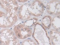 Invitrogen IDH2 Polyclonal Antibody:Antibodies:Primary Antibodies