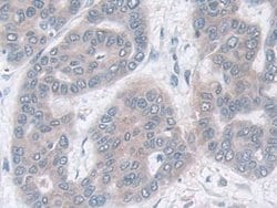 Invitrogen IDH2 Polyclonal Antibody:Antibodies:Primary Antibodies