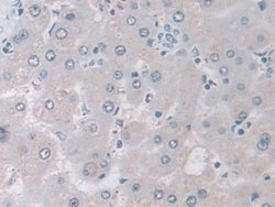 Invitrogen IDH2 Polyclonal Antibody:Antibodies:Primary Antibodies