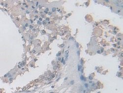 Invitrogen IDH2 Polyclonal Antibody:Antibodies:Primary Antibodies