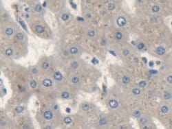 Invitrogen IARS Polyclonal Antibody 200 &mu;L | Buy Online | Invitrogen&trade; | Fisher Scientific
