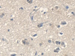 Invitrogen IARS Polyclonal Antibody 200 &mu;L | Buy Online | Invitrogen&trade; | Fisher Scientific
