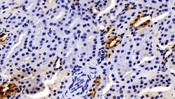 Invitrogen JAK2 Polyclonal Antibody:Antibodies, Polyclonal