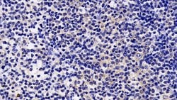 Invitrogen JAK2 Polyclonal Antibody:Antibodies, Polyclonal