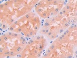 Invitrogen JAK2 Polyclonal Antibody:Antibodies, Polyclonal