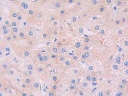 Invitrogen JAK2 Polyclonal Antibody:Antibodies, Polyclonal