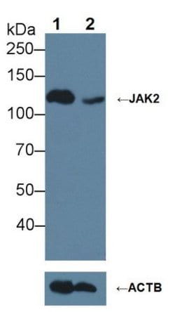 Invitrogen JAK2 Polyclonal Antibody:Antibodies, Polyclonal