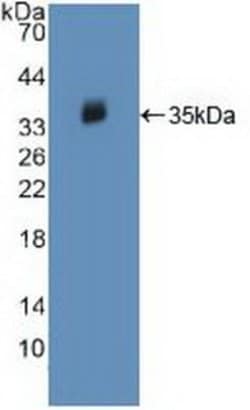 Invitrogen JAK2 Polyclonal Antibody:Antibodies, Polyclonal