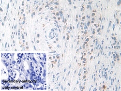 Invitrogen KLK11 Polyclonal Antibody 20 &mu;L; Unconjugated:Antibodies,
