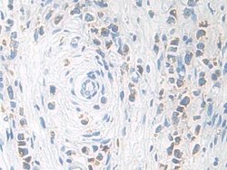 Invitrogen KLK11 Polyclonal Antibody:Antibodies:Primary Antibodies