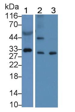 Invitrogen KLK11 Polyclonal Antibody 20 &mu;L; Unconjugated:Antibodies,