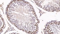Invitrogen KPNA2 Polyclonal Antibody:Antibodies:Primary Antibodies