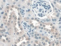 Invitrogen KATNA1 Polyclonal Antibody 20 &mu;L; Unconjugated:Antibodies,