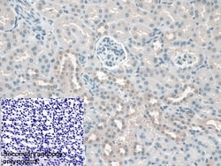 Invitrogen KATNA1 Polyclonal Antibody 20 &mu;L; Unconjugated:Antibodies,