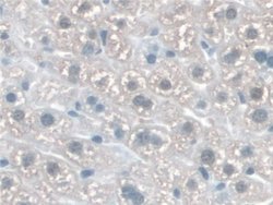 Invitrogen KATNA1 Polyclonal Antibody 20 &mu;L; Unconjugated:Antibodies,