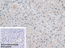 Invitrogen KATNA1 Polyclonal Antibody 20 &mu;L; Unconjugated:Antibodies,