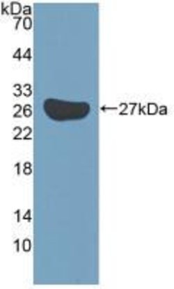 Invitrogen KATNA1 Polyclonal Antibody 20 &mu;L; Unconjugated:Antibodies,